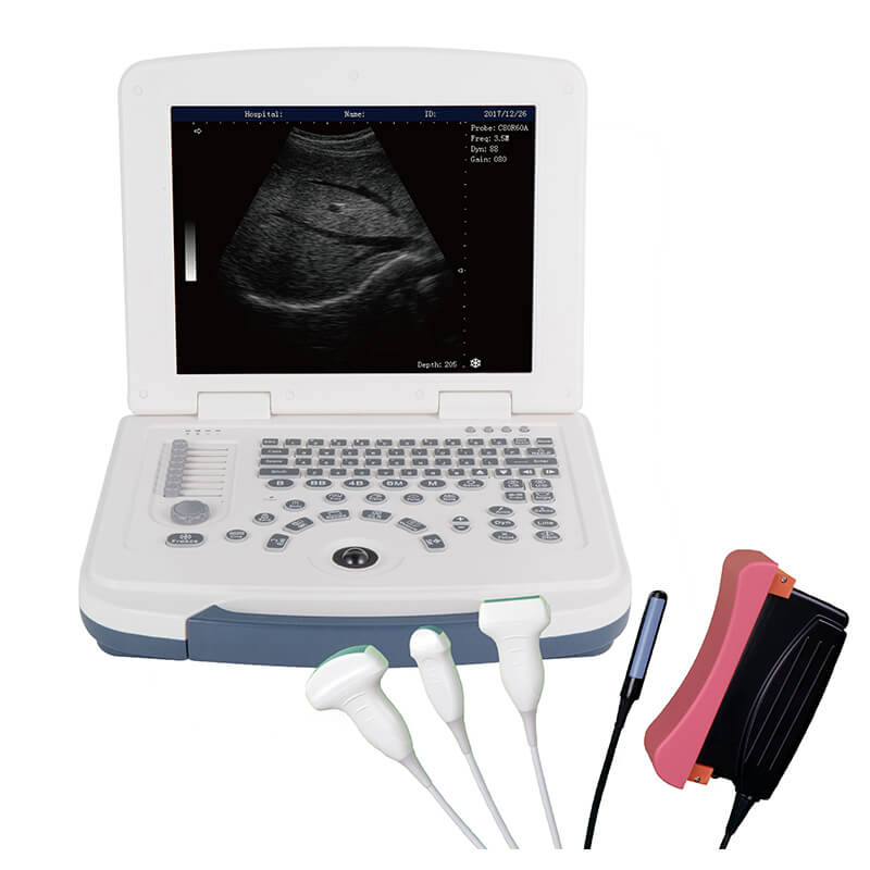 b/w ultrasound machine